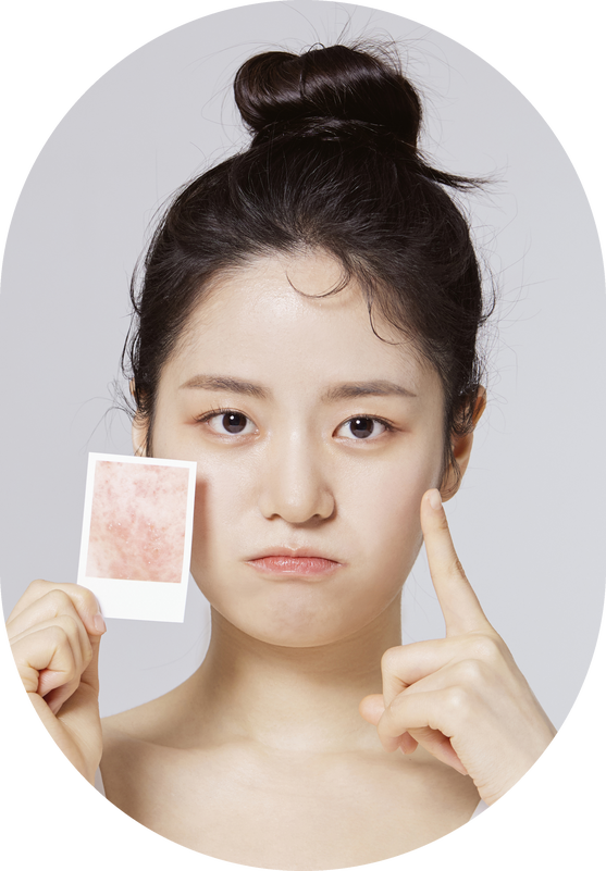 미라젯 스킨부스터